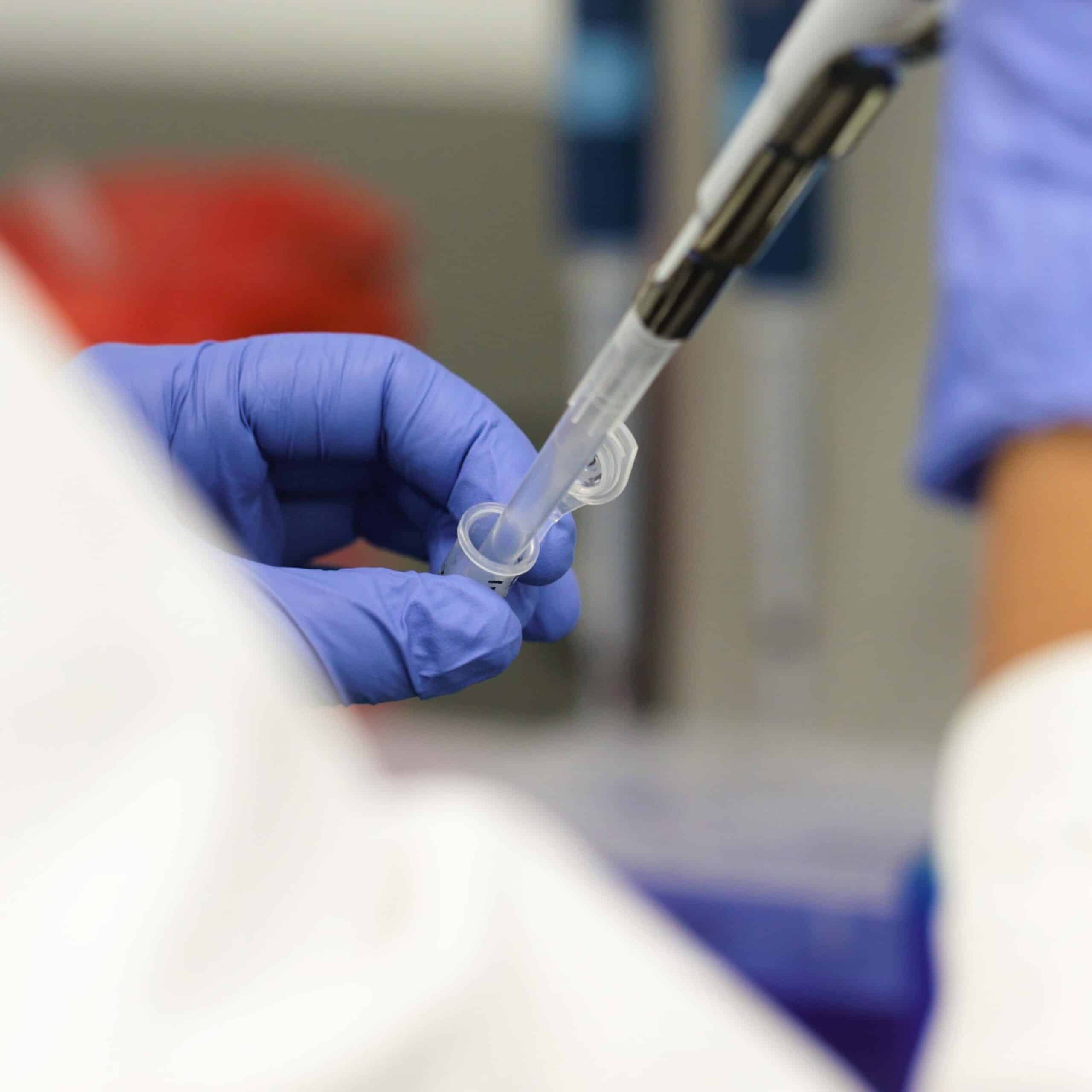 Colloidal Gold 7 point of care testing,POC testing, point-of-care testing, rapid diagnostics, rapid diagnostic, lateral flow, lateral flow assay, infectious disease diagnostic testing, what is a diagnostic test?, what is a rapid diagnostic test?, what is a lateral flow test?, dcn dx, dcn diagnostics, brendan o'farrell, rapid diagnostic test, what is a rapid diagnostic, what is lateral flow, point-of-need testing, immunoassay, sample collection, sample prep, microfluidics, lateral flow test, pipetting