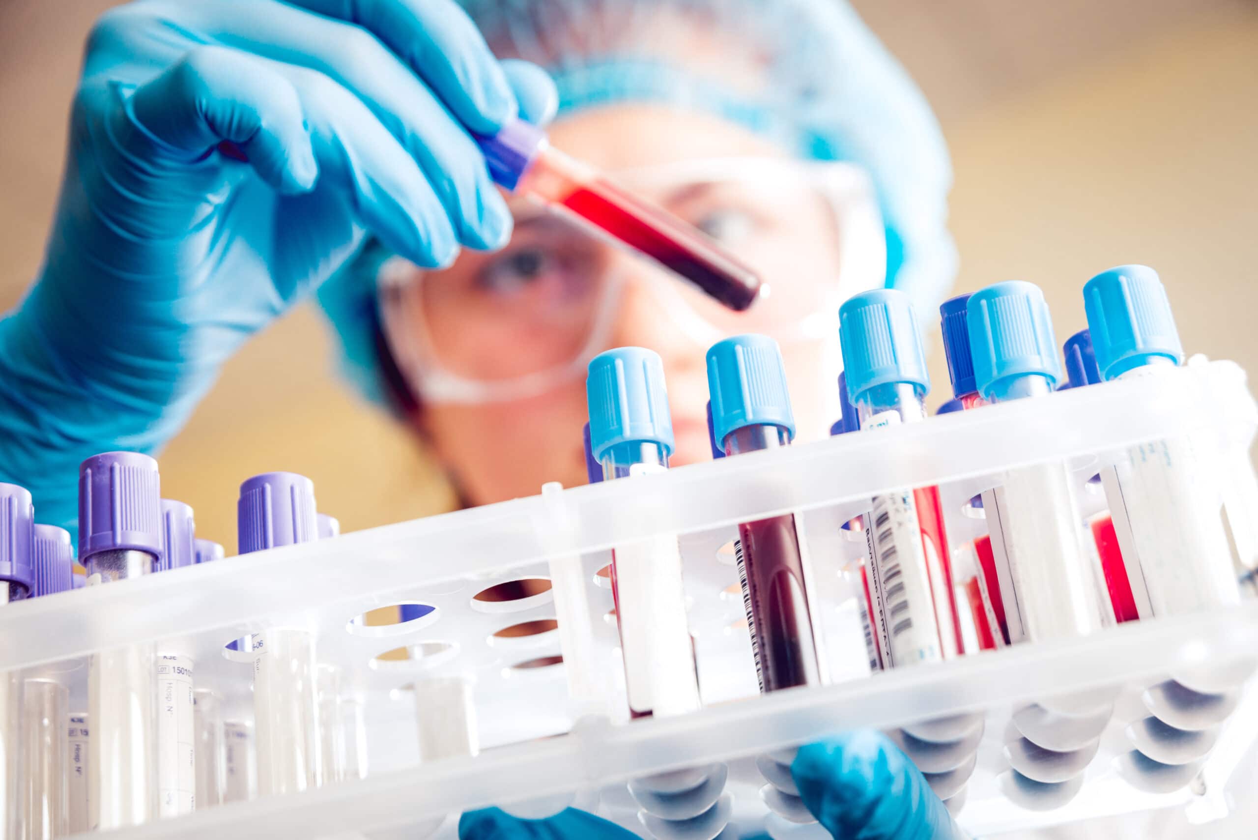 point of care testing,POC testing, point-of-care testing, rapid diagnostics, rapid diagnostic, lateral flow, lateral flow assay, infectious disease diagnostic testing, what is a diagnostic test?, what is a rapid diagnostic test?, what is a lateral flow test?, dcn dx, dcn diagnostics, brendan o'farrell, rapid diagnostic test, what is a rapid diagnostic, what is lateral flow, point-of-need testing, immunoassay, sample collection, sample prep, microfluidics, lateral flow test, blood-in-vials