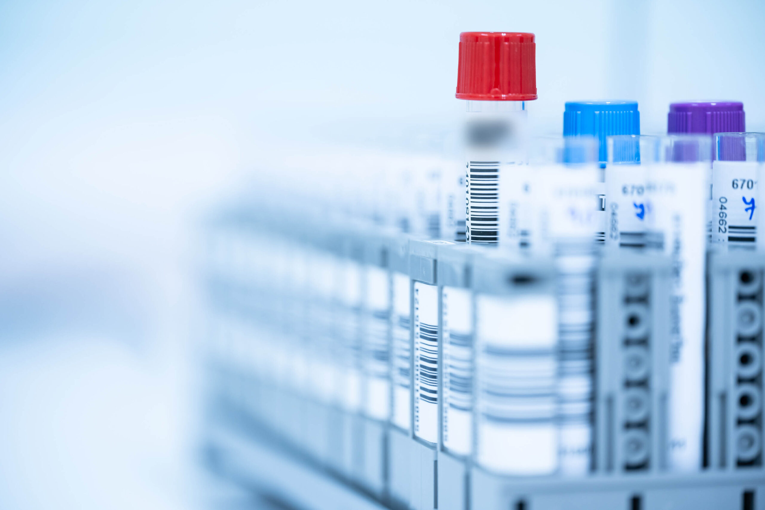 Clinical biospecimen samples in the DCN Dx laboratory